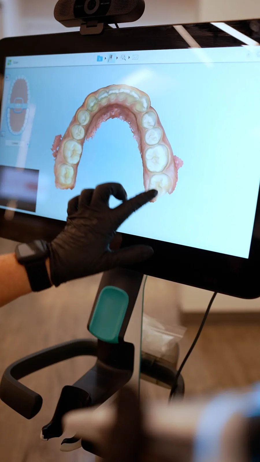 A digital iTero model of a smile