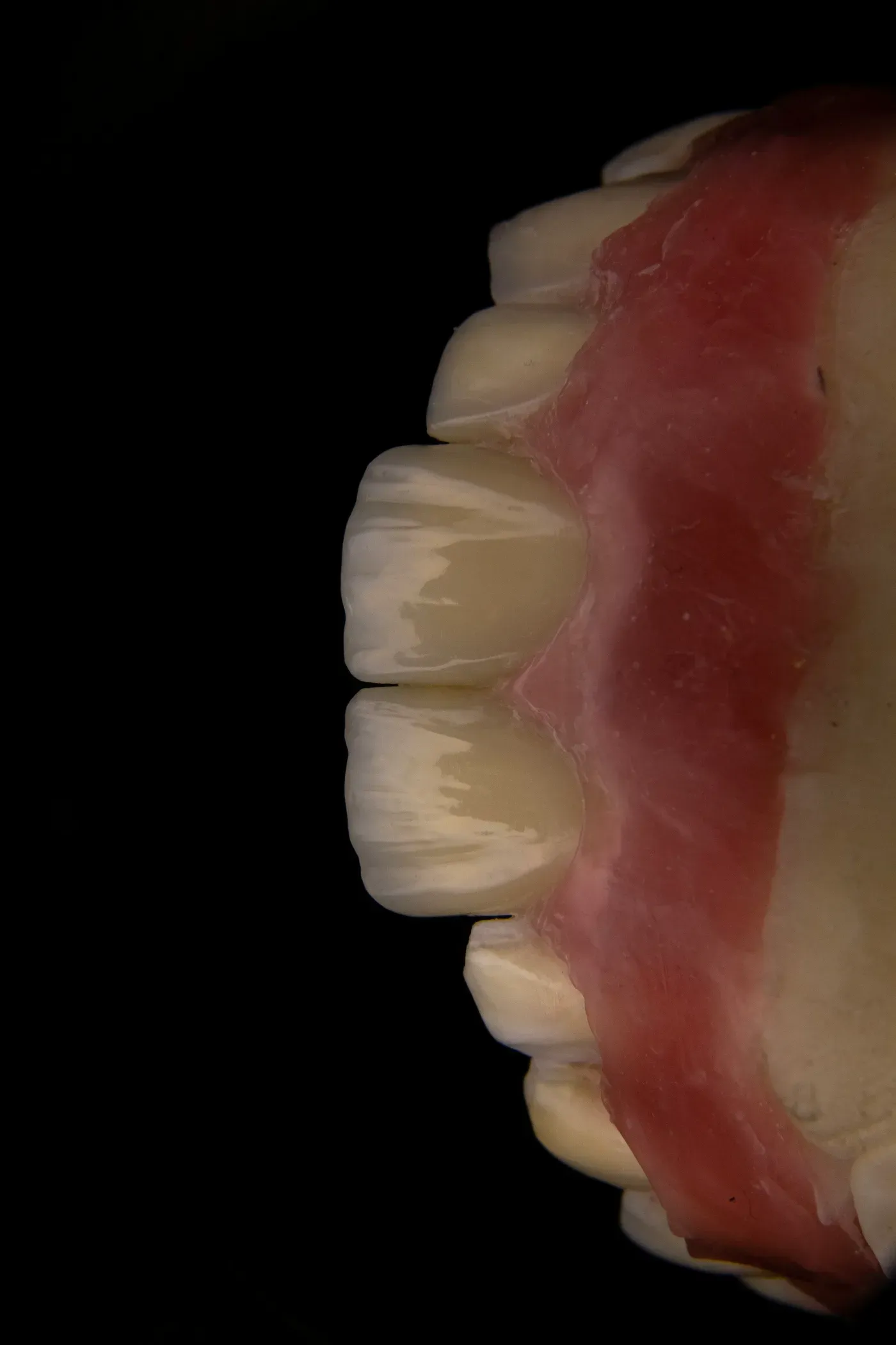 Close up of teeth on a dental model