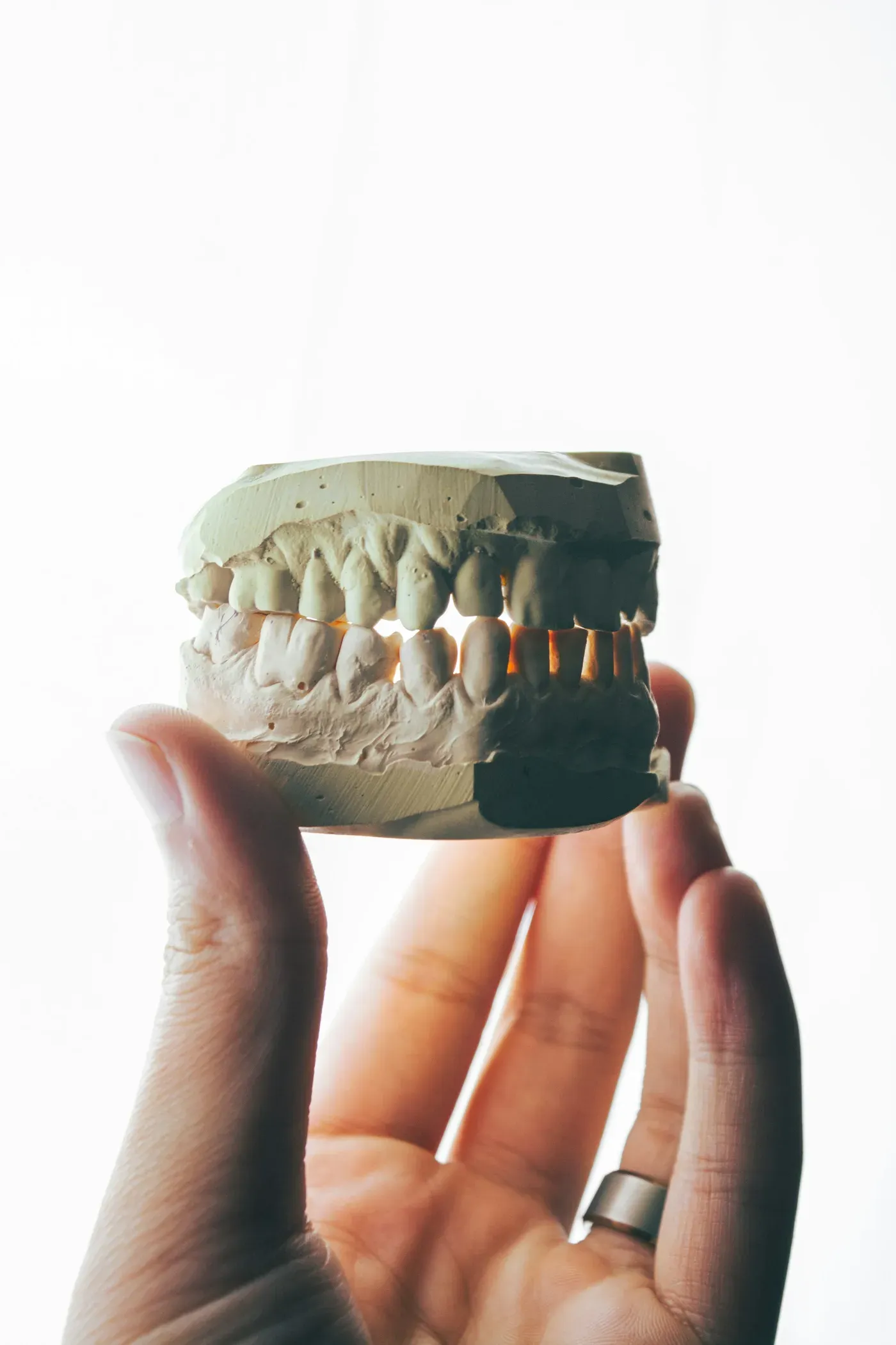 Hand holding a dental model